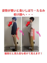 ニコ(Nico)/before・after　小顔・姿勢矯正