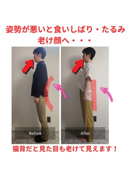 ニコ(Nico)/before・after　小顔・姿勢矯正