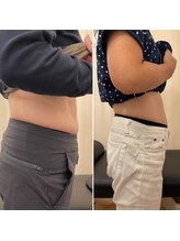 ナオ接骨院(NAO接骨院)/Before／After