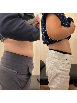 ナオ接骨院(NAO接骨院)/Before/After