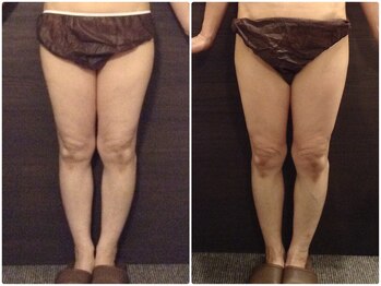 ウェリナ平和堂長久手院/小顔矯正/骨盤矯正/美脚サロン