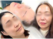 ツヤ肌に育つ！若見え効果