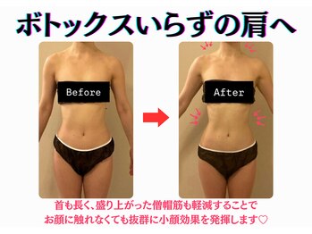 エーシーサロン 六本木店(acsalon)/お顔に触れずに小顔効果を発揮!