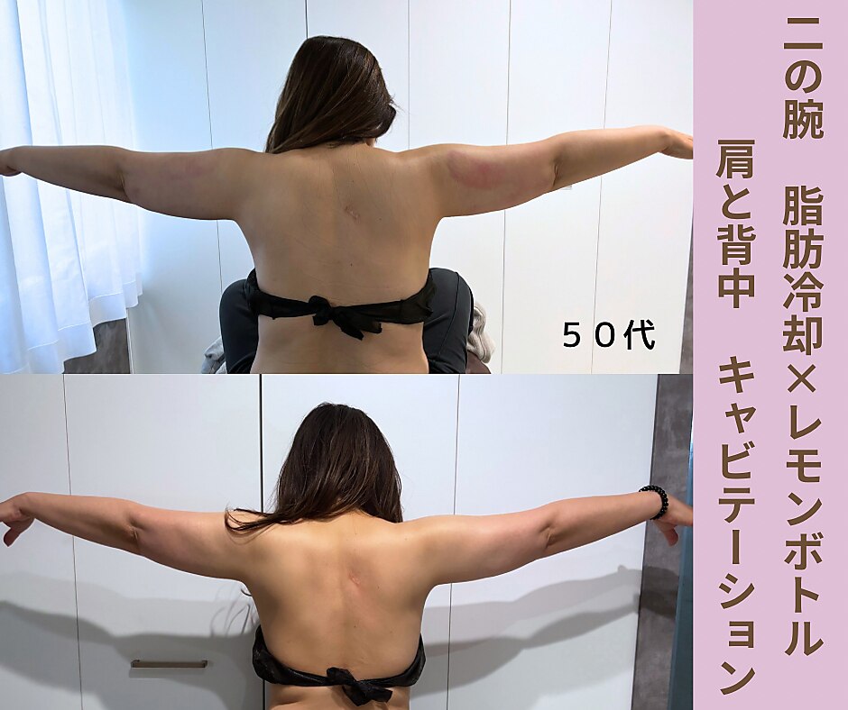 谷町六丁目駅でキャビテーションが人気のエステサロン｜ホットペッパー