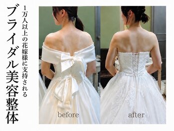練馬アカデミア美容整体院の写真/人気No.1美容整体☆1万人超の花嫁実績！どこから見てもドレス映えする体。自信いっぱいで臨むブライダル♪