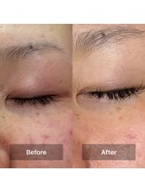 サロン ウイ(salon u'i)/～リブセラ～