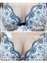 エステティック レイビス 青森店(RAYVIS)/驚きの変化！マシュマロ3Dバスト