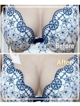 エステティック レイビス 青森店(RAYVIS)/驚きの変化!マシュマロ3Dバスト