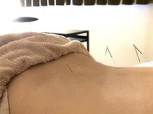 優癒/肩こり・腰痛にも