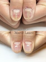 マリーロール 淀屋橋本店(Marie Laure)/自爪育成/深爪矯正/ネイルケア