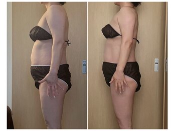 ココア(CoCoa)/活性リンパ洗浄