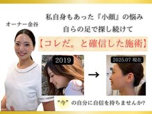 オーナー自身もこの施術で変化を遂げました!