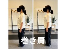 カワル整体 長嶺院/巻き肩