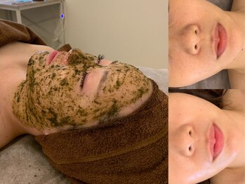 ラヴィエ ベル(La vie est belle)の写真/【ハーブピーリング¥8,250】ダウンタイムなしでつるんと艶肌へ。シミ・シワを改善し透明感あふれる素肌に。