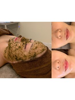 お肌をきれいにしたい