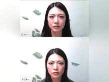 整体院 てんとてん 吉祥寺/小顔矯正