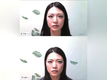 整体院 てんとてん 吉祥寺/小顔矯正