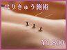 【深層の筋肉にアプローチ】慢性的な肩こり腰痛へのはりきゅう施術