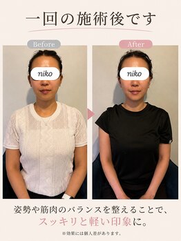 ラモアナ 布施店(lamoana)の写真/印象も変わるかも
すっきりフェイスラインへ