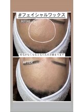 美顔秘密基地 新宮/フェイシャルワックス