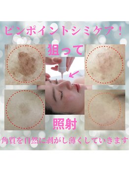 アイリープ(eyeleap)/狙った場所にシミケア￥5980