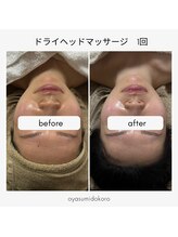 おやすみ処(OYASUMI処)/温石ヘッドスパの効果