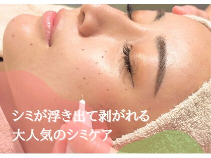 ジーニー(genie)の写真