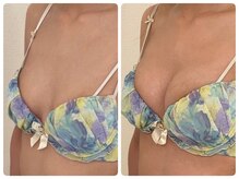 モナンジュ(ramonange)/ボディライン整えたい方