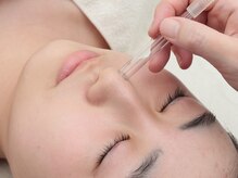 レネ(Renee)の雰囲気（水素で毛穴洗浄後、更に細かい汚れを吸引でしっかり取り除きます）