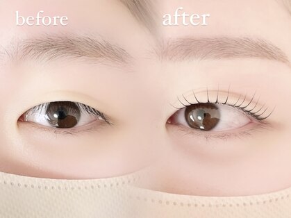 ソル(sol)の写真