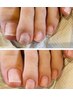 【ジェル塗布ヘア用】Foot 指輪周り角質除去