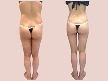 シェリートーキョー 成田店(Cherie Tokyo)/Before＆After /成田店