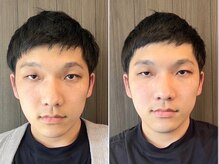 ククナ 新横浜駅前サロン/小顔矯正ビフォーアフター　