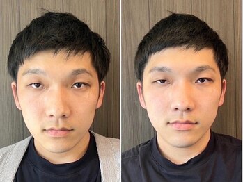 ククナ 新横浜駅前サロン/小顔矯正ビフォーアフター　