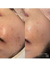 エクラ(eclat)/クリスティーナ