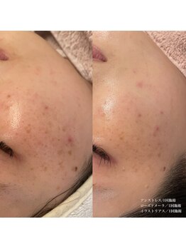 エクラ(eclat)/クリスティーナ