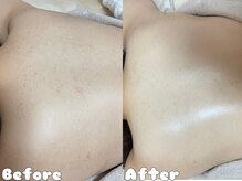 グラシア 倉敷店(Gracia)の雰囲気(エステ業界No.1☆REVIハーブピーリング♪ボディおすすめです!)