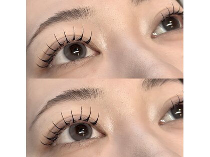 リグ(LIG)の写真