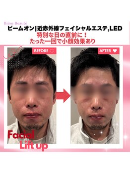 ビジュボーテ(Bijou Beaute)/近赤外線フェイシャルエステ,LED