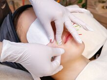 ミエリア美容鍼灸院(mielia美容鍼灸院)の雰囲気（当院の美容鍼は他院にはないコースや打ち方に秘密があります。）