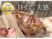 ブロッサム(Blossom)