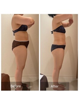 ルナスーリヤ 表参道店/セルドライブプロ＆筋膜リリース