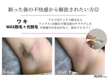 アルゴ 吹田千里山駅前店(ALGO)/ALGO式WAX脱毛+光脱毛