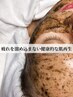 【毛穴】剥離なしハーブピーリング+イオン導入＋ヘッドスパ