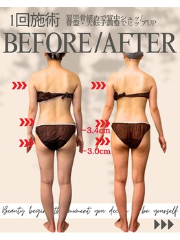 エイエービジュー(Aa.bijou)/