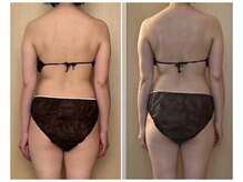 ココア(CoCoa)/活性リンパ洗浄