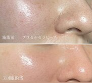 テテメルティ(te-te melty)