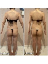 エミア(Emia)/全身痩せ×歪み改善◎120分 １回