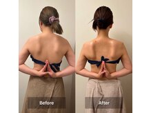 リバース(Rebirth)/1ヶ月短期集中コース