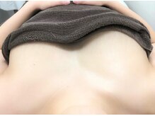 施術写真☆二の腕スッキリ！施術後の効果の違いに感動☆